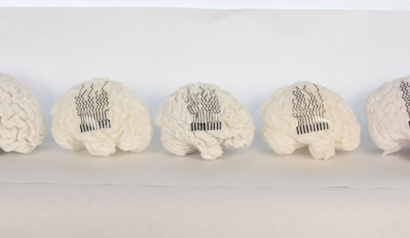 研究人员开发出可根据个体大脑几何结构定制的3D打印生物电极