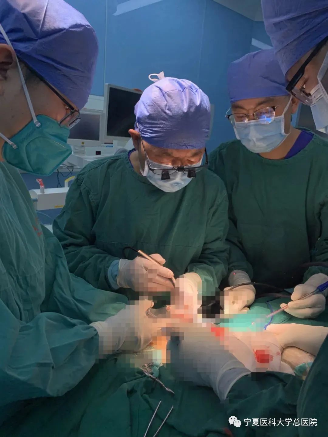 3D打印个性化骨干假体置换实现保留骨骺的青少年骨肉瘤的保肢治疗术