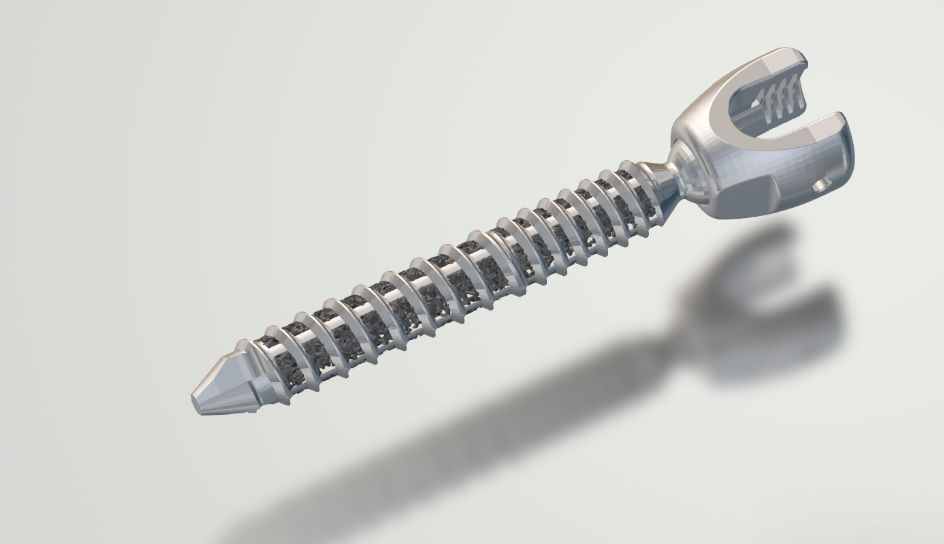 3D打印多孔骨整合新突破！Croom Medical推出Biofuse技术，落地多类骨科植入物