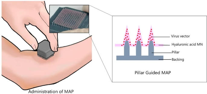 东京大学3D打印微针贴片研究登自然子刊，实现无痛、高效疫苗递送与完全保护