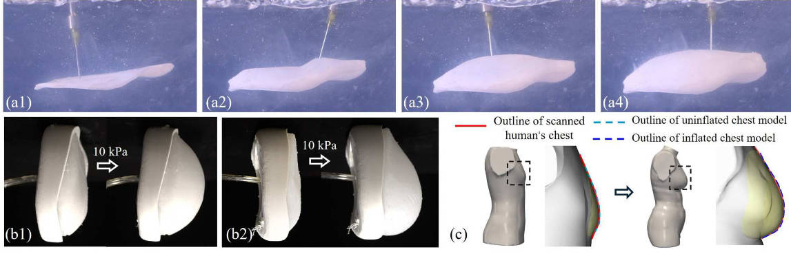 具有可变厚度的双层胸部模型的多轴 ESP 工艺