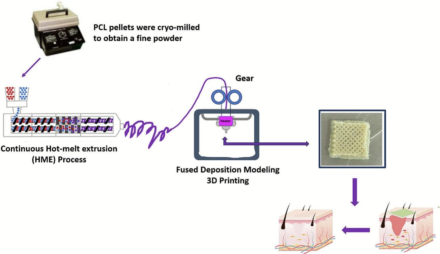 密西西比大学研发出可降解、抗菌的3D打印支架贴片，用于治疗慢性伤口