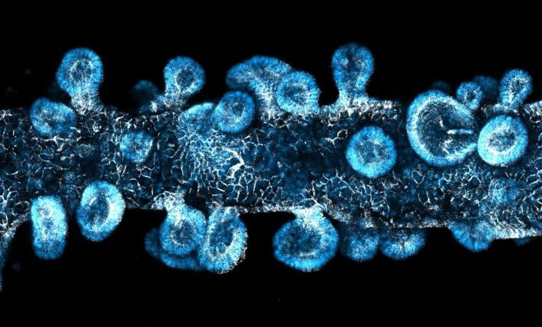 Nature子刊：加州大学开发出新型复合生物材料，干细胞3D打印改善类器官发育