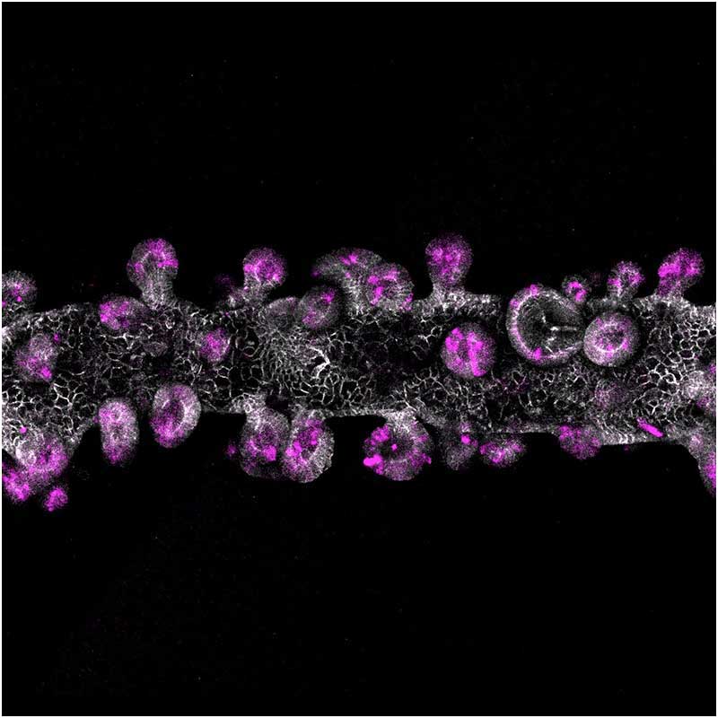 加州大学旧金山分校和Biohub的科学家开发出新材料，用于培养更一致的实验室器官