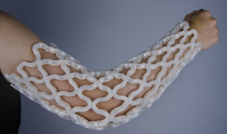 Castomize公司的热成型3D打印矫形石膏已将成本降低了高达25%