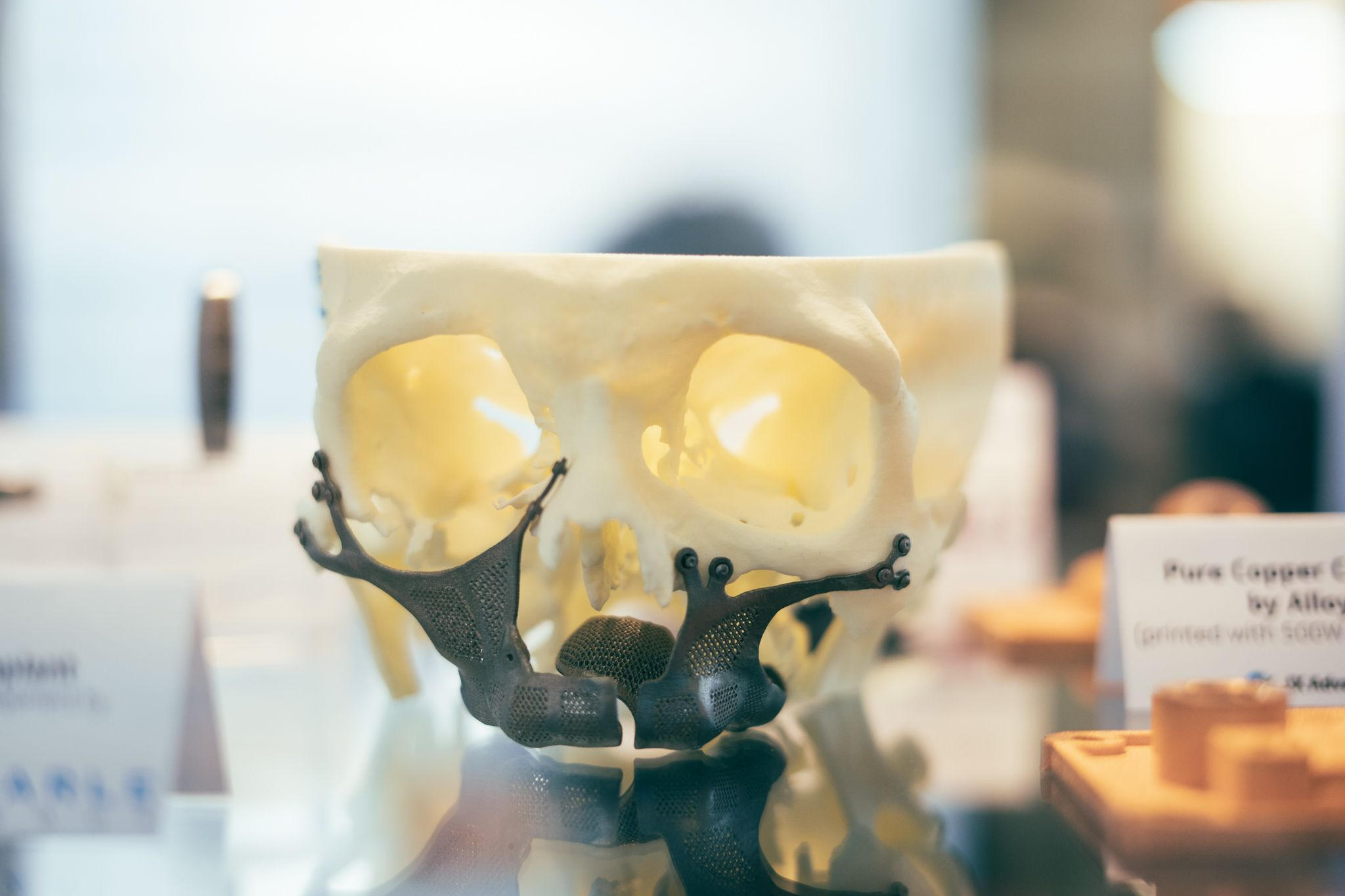 TANIOBIS推钽铌合金3D打印粉末，欲替代钛合金做植入物