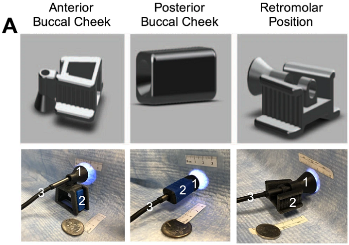 口腔中三个不同区域的施用器的3D示意图和照片。照片展示了在人体工程学临床研究中使用的集成单元,包括施用器(1)、咬翼(2)和内窥镜(3)。 口腔中三个不同区域的施用器的3D示意图和照片。照片展示了在人体工程学临床研究中使用的集成单元,包括施用器(1)、咬翼(2)和内窥镜(3)。