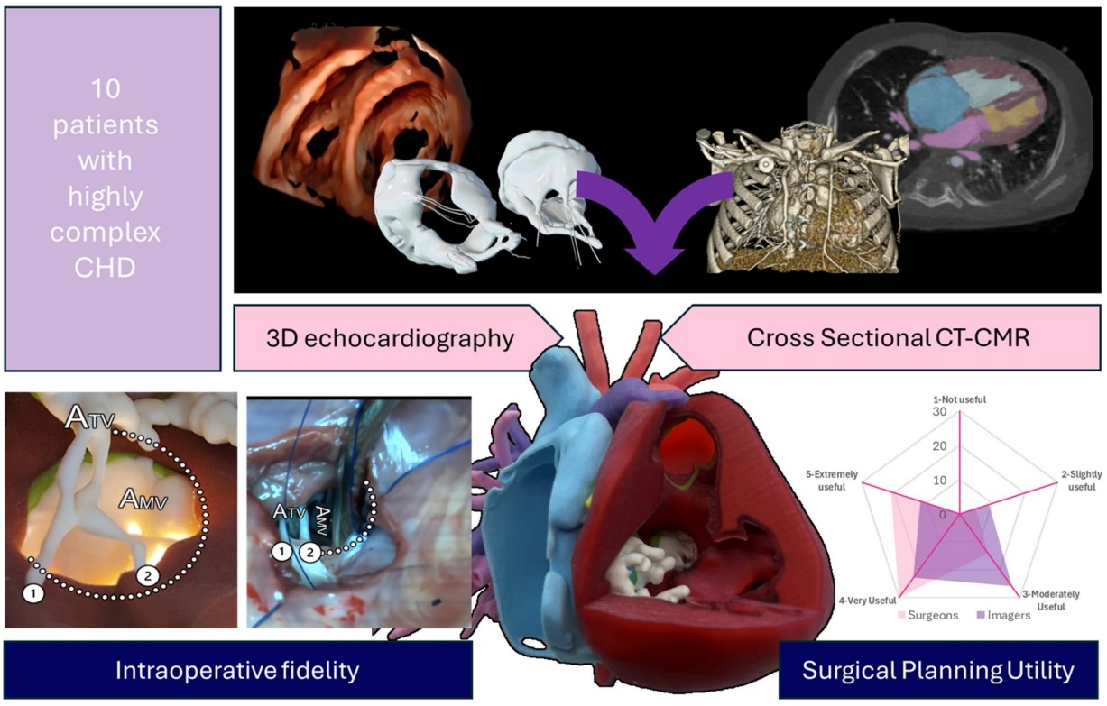 多模态融合成像3D打印心脏模型比影像仪更能帮助外科医生进行诊断